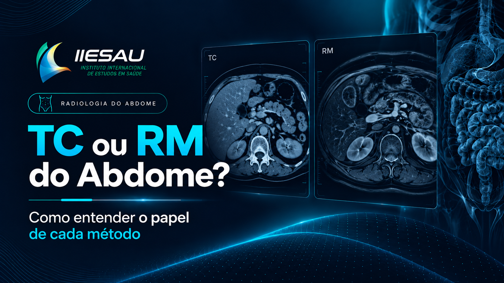 TC ou RM do Abdome: como entender o papel de cada método?